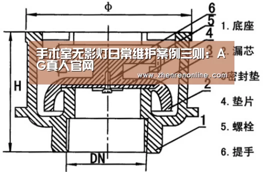 手术室无影灯日常维护案例三则:AG真人官网(图3) AG真人游戏平台